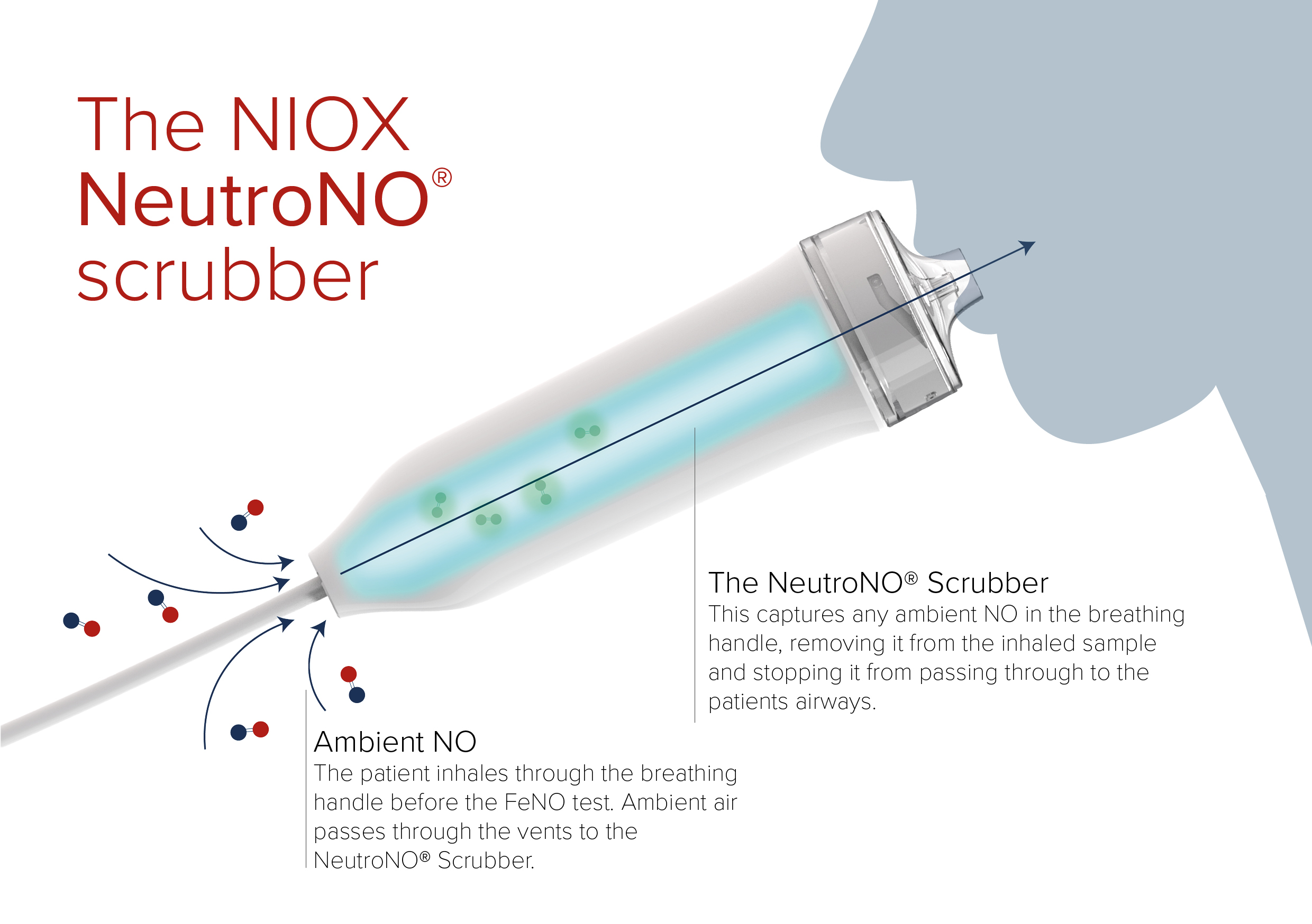 What’s in the air matters: Ambient NO and FeNO testing